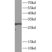 WB analysis of K562 cells, using DDIT3 antibody (1/1000 dilution).