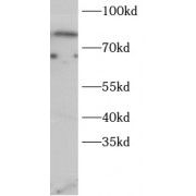 WB analysis of HeLa cells, using FOXO1 antibody (1/600 dilution).