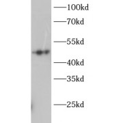 WB analysis of mouse liver tissue, using GSK3A antibody (1/1000 dilution).