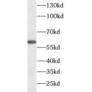 WB analysis of 293T cells, using HDAC2 antibody (1/1000 dilution).