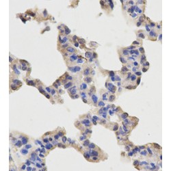 Transcription Factor p65 / NFKB3 (RELA) Antibody