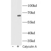 WB analysis of NIH/3T3 cells (treated with 100 nM Calyculin A at 37 °C for 30 min after serum-starvation overnight), using Phospho-NF-kB p65-S536 antibody (1/1000 dilution).