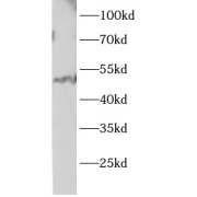 WB analysis of HepG2 cells, using Parkin antibody (1/1000 dilution).