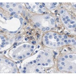 Platelet Endothelial Cell Adhesion Molecule / CD31 (PECAM1) Antibody