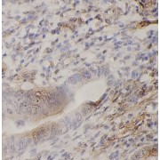 abx011424
