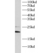 WB analysis of Jurkat cells, using BAD antibody (1/1000 dilution).