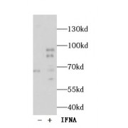 WB analysis of HeLa cells (treated with 100 ng/ml IFNA at 37 °C for 30 minutes after serum-starvation overnight), using STAT1 pY701 antibody (1/600 dilution).