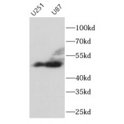 WB analysis of various lysates, using TH antibody (1/600 dilution).