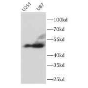 WB analysis of various lysates, using TH antibody (1/600 dilution).