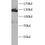 WB analysis of HepG2 cells, using Vinculin antibody (1/1000 dilution).