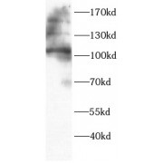 WB analysis of Jurkat cells, using ADAM17 antibody (1/1000 dilution).