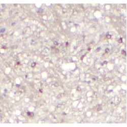 Twist Transcription Factor (TWIST) Antibody