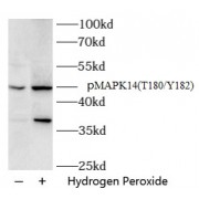 WB analysis of HeLa cells, using MAPK14 pT180/Y182 antibody (1/1000 dilution).