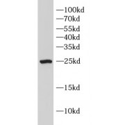 WB analysis of 293T cells, using ERAB antibody (1/1000 dilution).