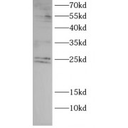 WB analysis of Raji cells, using GRB2 antibody (1/1000 dilution).