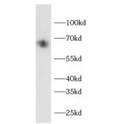WB analysis of THP-1 cells, using IRAK-3 antibody (1/1000 dilution).