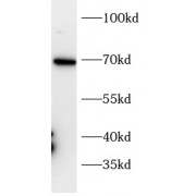WB analysis of A549 cell lysates, using CADM1 antibody (1/1000 dilution).