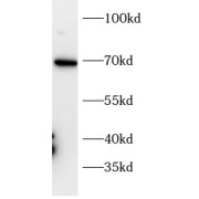 abx146655