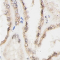 Cluster of Differentiation 40 Ligand / TNFSF5 (CD40LG) Antibody