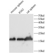 WB analysis of various lysates, using CD154 antibody (1/1000 dilution).