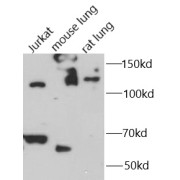 abx146975