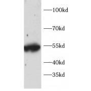 WB analysis of HeLa cells, using TRAF2 antibody (1/1000 dilution).
