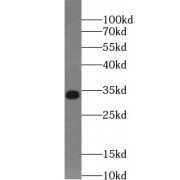 WB analysis of Jurkat cells, using MYD88 antibody (1/1000 dilution).