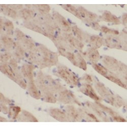 Voltage-Dependent Anion-Selective Channel Protein 1 (VDAC1) Antibody