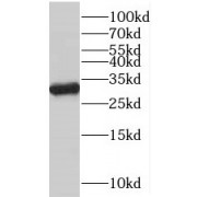 WB analysis of HeLa cells, using VDAC1 antibody (1/500 dilution).