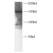 abx147238