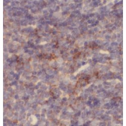 Toll Like Receptor 2 (TLR2) Antibody