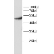 WB analysis of HeLa cells, using PDK1 antibody (1/1000 dilution).