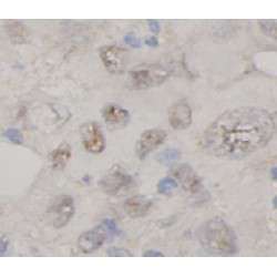 Tumor Necrosis Factor Alpha-Induced Protein 3 (TNFAIP3) Antibody