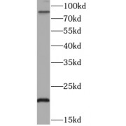 WB analysis of K562 cells, using TNFAIP3 antibody (1/1000 dilution).