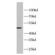 WB analysis of mouse brain tissue, using ADRA2A antibody (1/1000 dilution).