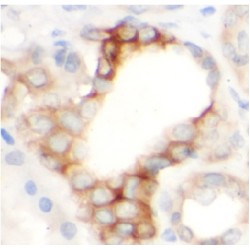 Beclin 1 (BECN1) Antibody