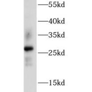 WB analysis of mouse kidney, using AQP2 antibody (1/1000 dilution).