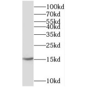 WB analysis of mouse brain tissue, using CST3 antibody (1/1000 dilution).