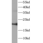 WB analysis of A549 cells, using ATP5H antibody (1/1000 dilution).