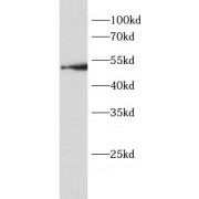 WB analysis of HeLa cells, using BACE1 antibody (1/1000 dilution).