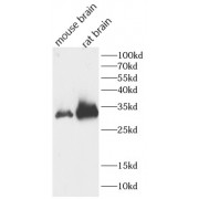 WB analysis of various lysates, using calretinin antibody (1/1000 dilution).