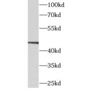 WB analysis of A549 cells, using CALCRL antibody (1/1000 dilution).