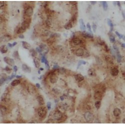 Platelet Derived Growth Factor Receptor Beta (PDGFRB) Antibody