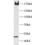 WB analysis of mouse lung tissue, using PDGFRB antibody (1/1000 dilution).