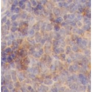 IHC-P analysis of rat spleen tissue, using CD44 antibody (1/200 dilution).