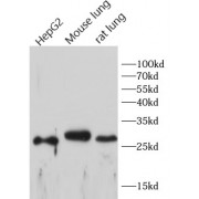 WB analysis of various lysates, using CD68 antibody (1/1000 dilution).