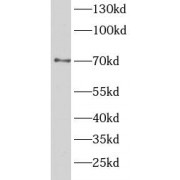 WB analysis of HeLa cells, using TAB2 antibody (1/1000 dilution).