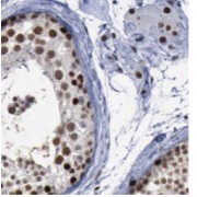 IHC-P analysis of human testis tissue, using STAG3 antibody (1/200 dilution).