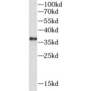 abx149601