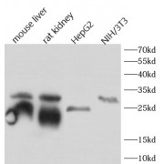 WB analysis of various lysates, using CTSB antibody (1/1000 dilution).